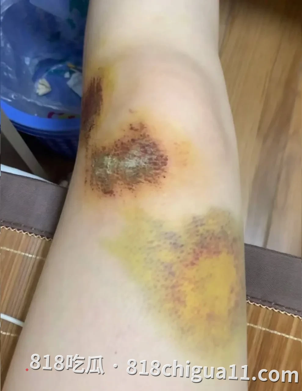 网友投稿:东南亚绑匪团伙,敲诈15万人民币,再以2万U把我卖到园区