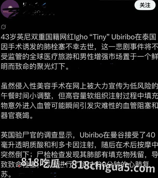 古有关羽刮骨疗毒,现有网红填充增茎!英籍43岁网红 Tiny为震“雄风”, 赴泰打针填充增大阴茎,填充物入肺惨死!下葬用价值74.5万美元纯金棺材!