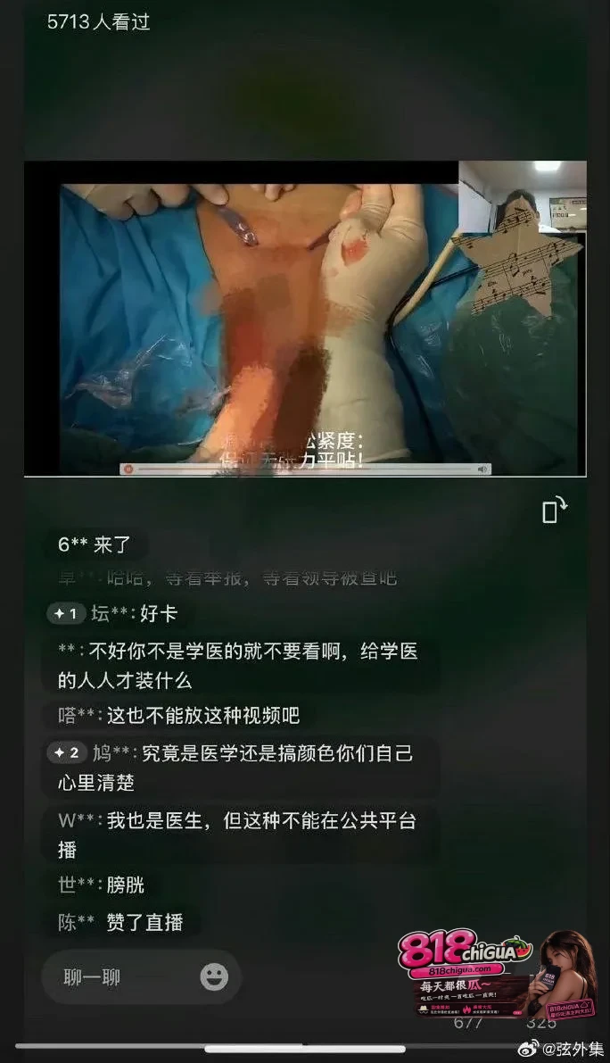产科手术完整视频曝光!山西医科大学第一医院实习护士晒产科手术暴露女患者隐私部位,引爆全网围观。