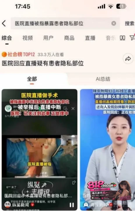 产科手术完整视频曝光!山西医科大学第一医院实习护士晒产科手术暴露女患者隐私部位,引爆全网围观。