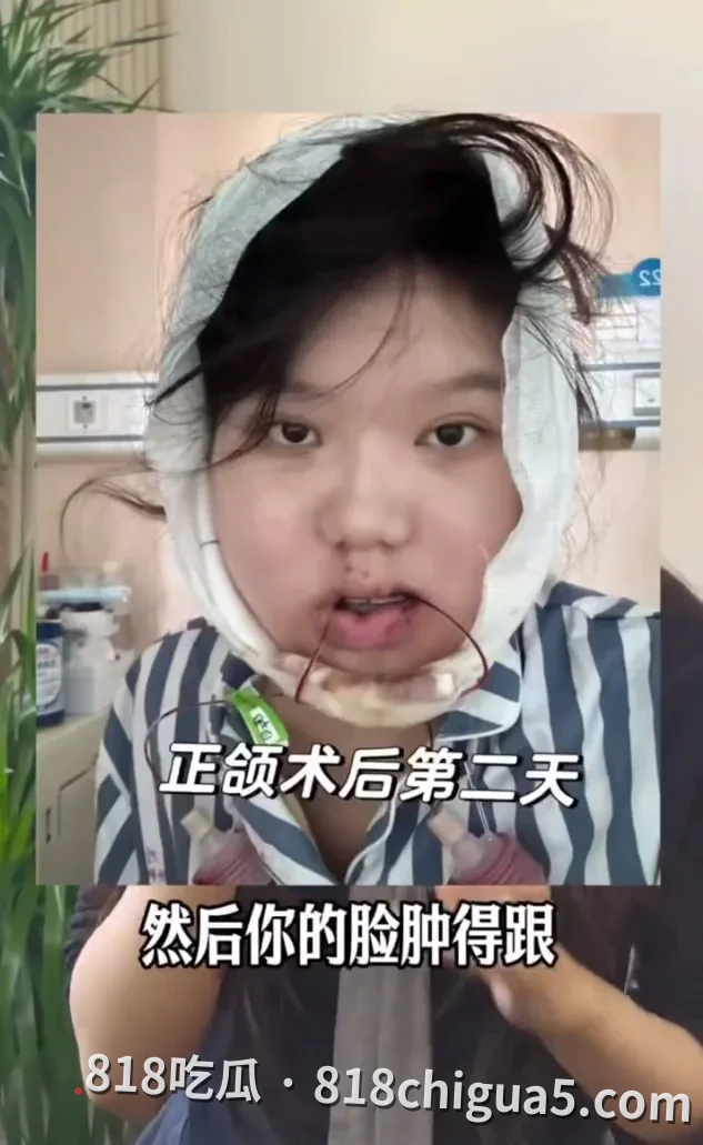 无医疗事故却索赔200万?“武大口腔手术纠纷”反转:当维权变成博弈,谁在透支社会信任?
