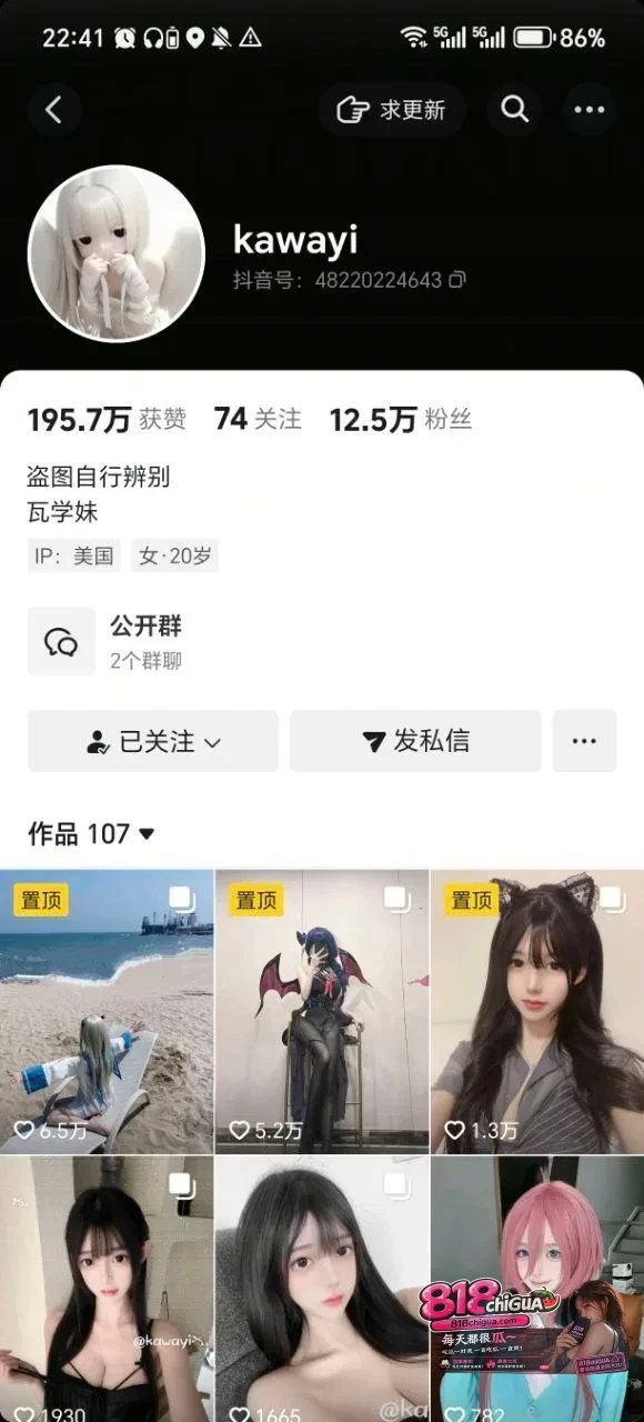 抖音高颜值女神呆呆宝/kawayi 高价自购情趣内衣自慰福利极品美乳揉捏超诱惑