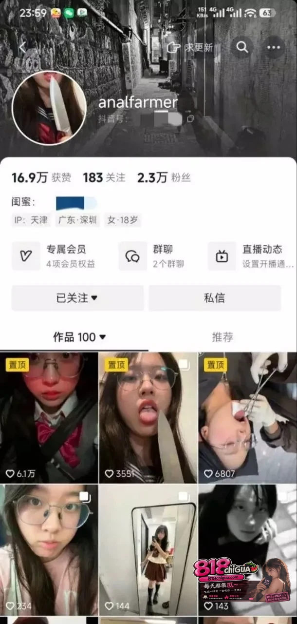 抖音网红 analfarmer 私拍泄露 清纯嫩妹饥渴淫荡 搔首弄姿被金主肉棒拿下!