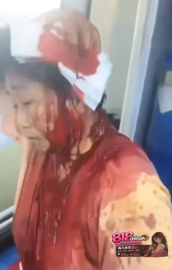 徐州铜山区大许镇突发砍人事件!极兔快递员工持刀伤人看上多人,现场一度混乱引发网友讨论。