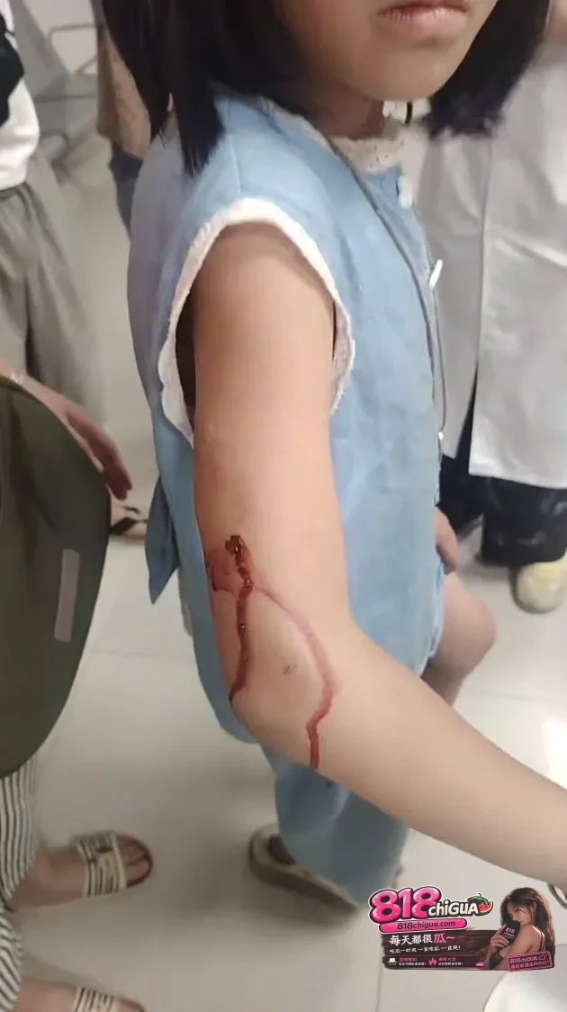 新化洋溪镇突发惊险一幕:恶犬当街疯狂扑咬小女孩,危急时刻母亲持棍打趴恶犬!