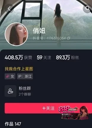 【抖音女神】微秘圈气质轻熟百万粉丝抖主 【俏妞】最新福利视频一起欣赏极品蜜桃臀